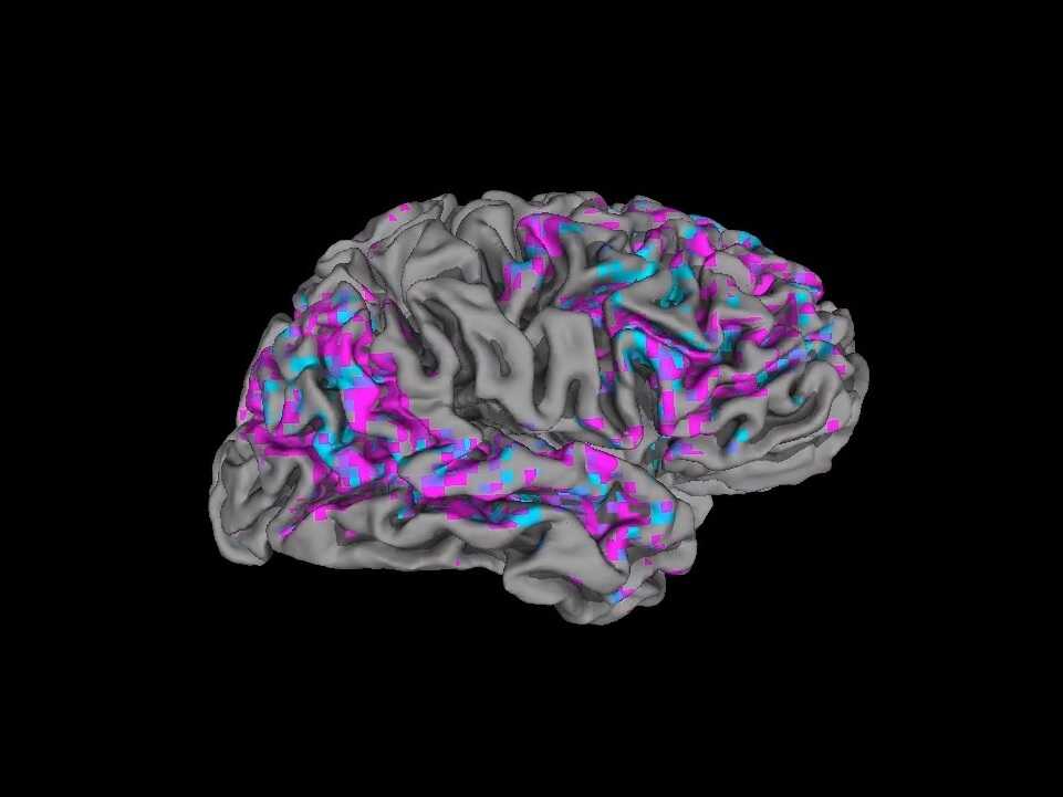 fMRI brain imaging — the starting-line toolkit